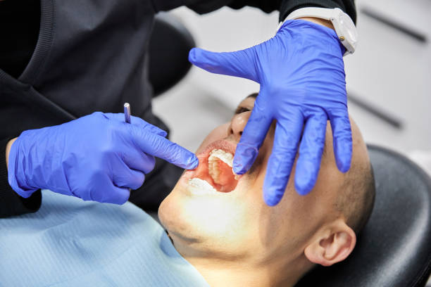 Best Emergency Dental Care for Sports Injuries in Tacoma, WA